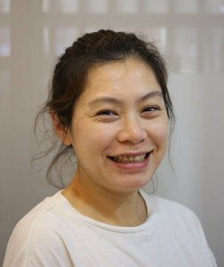 矯正後露出自信微笑